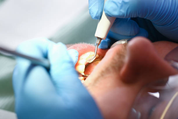 Best Broken or Chipped Tooth Repair in Knightsen, CA